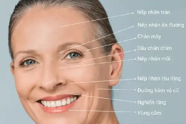 Giải mã sức mạnh của Botulinum Toxin trong việc giảm nếp nhăn